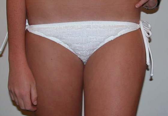 Sunflower EURO TIE RUFFLE bottom