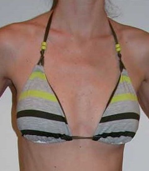 Splendid - Rainbow Stripe Triangle Bra